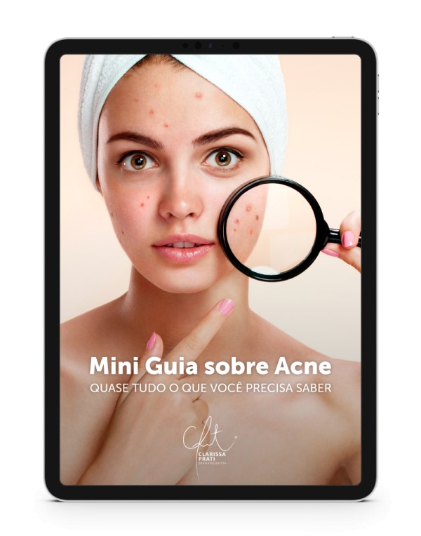 Mini Guia Sobre Acne