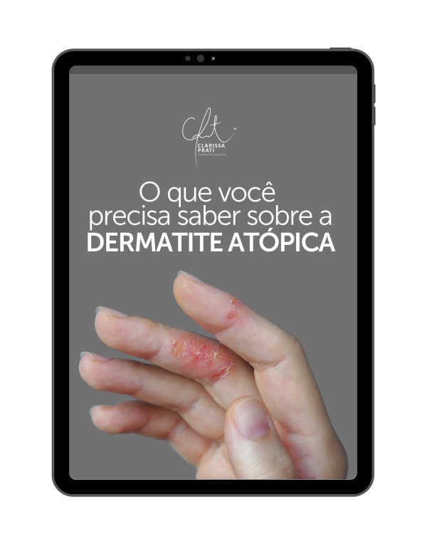 Dermatite Atópica: O que você precisa saber