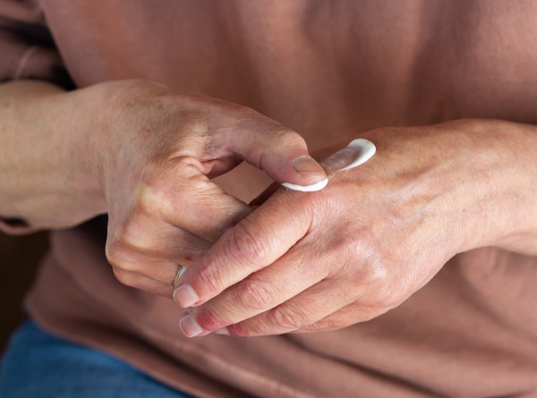 Dermatite Atópica em Adultos: Por Que Está mais Frequente e o Que Fazer Agora